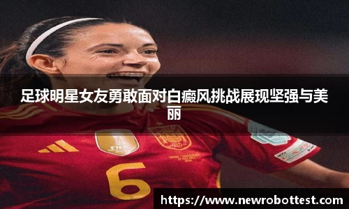 足球明星女友勇敢面对白癜风挑战展现坚强与美丽